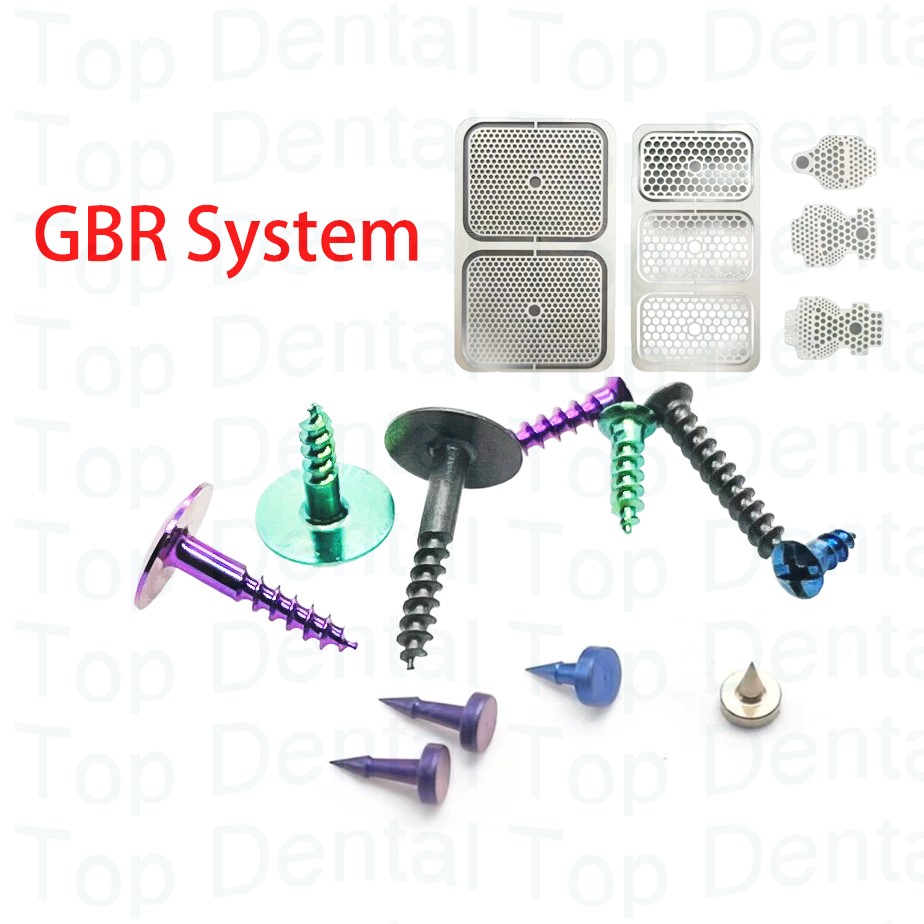 Stabilizer Screw In - Sistema Dental GBR, tornillos de hueso,